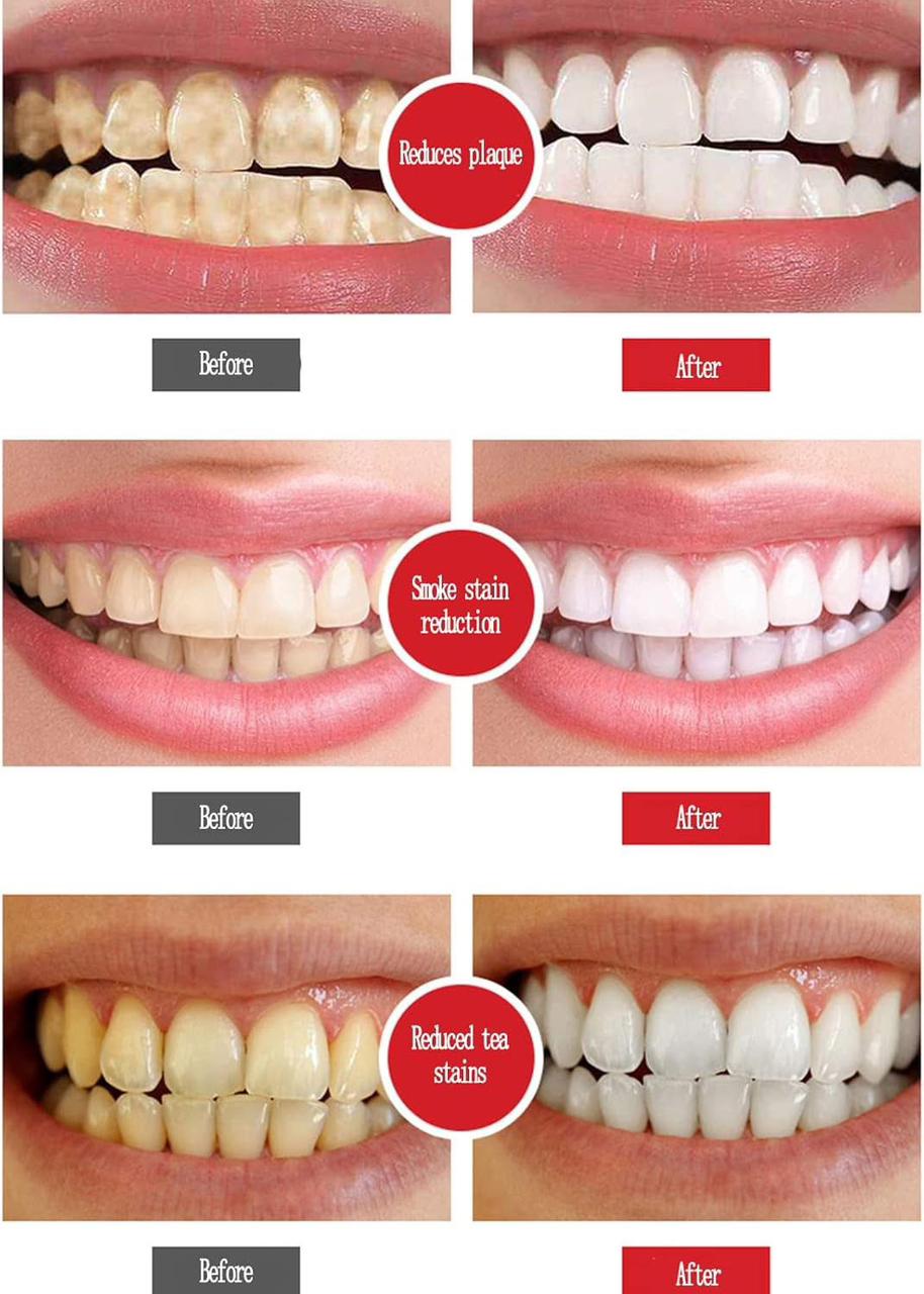 SP-4 Probiotics Brightening Toothpaste